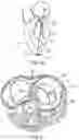 Fig. 65 - METHODS AND DEVICES FOR VENTRICULAR RESHAPING AND HEART VALVE RESHAPING