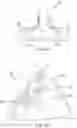Fig. 75 - METHODS AND DEVICES FOR VENTRICULAR RESHAPING AND HEART VALVE RESHAPING