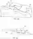 Fig. 77 - METHODS AND DEVICES FOR VENTRICULAR RESHAPING AND HEART VALVE RESHAPING