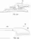 Fig. 79 - METHODS AND DEVICES FOR VENTRICULAR RESHAPING AND HEART VALVE RESHAPING