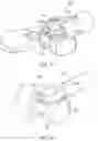 Fig. 83 - METHODS AND DEVICES FOR VENTRICULAR RESHAPING AND HEART VALVE RESHAPING
