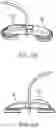 Fig. 89 - METHODS AND DEVICES FOR VENTRICULAR RESHAPING AND HEART VALVE RESHAPING