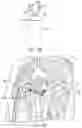 Fig. 90 - METHODS AND DEVICES FOR VENTRICULAR RESHAPING AND HEART VALVE RESHAPING