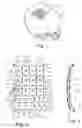 Fig. 02 - Bone implant for the reconstruction of an osseous defect and for guiding a marking and/or processing tool for transferring required osteotomy situations