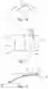 Fig. 05 - Bone implant for the reconstruction of an osseous defect and for guiding a marking and/or processing tool for transferring required osteotomy situations