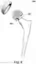 Fig. 09 - Magnetic prosthetic