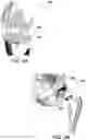 Fig. 10 - Magnetic prosthetic