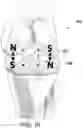 Fig. 11 - Magnetic prosthetic