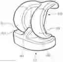 Fig. 01 - Knee prosthesis