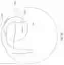 Fig. 15 - Knee prosthesis