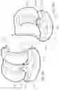 Fig. 19 - Knee prosthesis