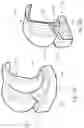 Fig. 20 - Knee prosthesis