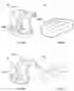 Fig. 22 - Knee prosthesis