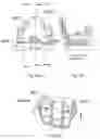 Fig. 23 - Knee prosthesis