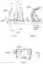 Fig. 25 - Knee prosthesis