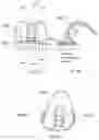 Fig. 29 - Knee prosthesis