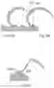 Fig. 30 - Knee prosthesis
