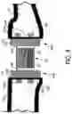 Fig. 07 - Metarsophalangeal joint replacement device and methods