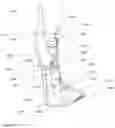 Fig. 13 - EXOSKELETON, ORTHOSIS, WEARABLE DEVICE OR MOBILE ROBOTS USING MAGNETORHEOLOGICAL FLUID CLUTCH APPARATUS