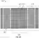 Fig. 11 - Stents having a hybrid pattern and methods of manufacture