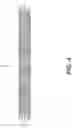 Fig. 04 - Implantable stent