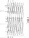 Fig. 06 - Implantable stent