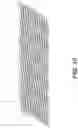 Fig. 10 - Implantable stent