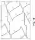 Fig. 12 - Implantable stent