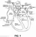 Fig. 02 - Stent loading device