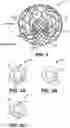 Fig. 03 - Stent loading device
