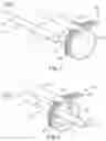 Fig. 02 - Apparatus and method for gastric volume reduction utilizing an expandable member
