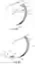 Fig. 10 - Apparatus and method for gastric volume reduction utilizing an expandable member
