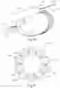 Fig. 11 - Apparatus and method for gastric volume reduction utilizing an expandable member