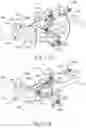Fig. 15 - Apparatus and method for gastric volume reduction utilizing an expandable member