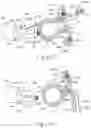 Fig. 16 - Apparatus and method for gastric volume reduction utilizing an expandable member