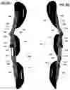 Fig. 08 - Adjustable low-profile orthopedic hip brace