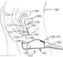 Fig. 01 - Female urine device