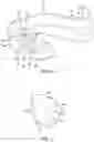 Fig. 05 - Set of mandibular advancement splints with adjustable advancement, kit for mandibular advancement and method of adjusting mandibular advancement using same
