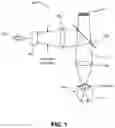 Fig. 02 - Methods and systems for large spot retinal laser treatment