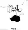 Fig. 05 - Methods and systems for large spot retinal laser treatment