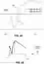 Fig. 06 - Methods and systems for large spot retinal laser treatment