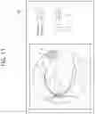 Fig. 16 - Ophthalmic treatment device, method for controlling ophthalmic treatment device, and fundus lesion treatment method