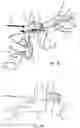 Fig. 12 - Devices and methods for treating eyelids