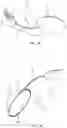 Fig. 13 - Devices and methods for treating eyelids