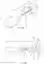 Fig. 14 - Devices and methods for treating eyelids
