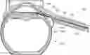 Fig. 01 - Ab externo intraocular shunt placement