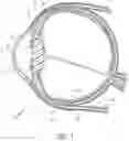 Fig. 02 - Ab externo intraocular shunt placement