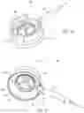 Fig. 06 - Ab externo intraocular shunt placement