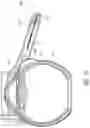 Fig. 11 - Ab externo intraocular shunt placement