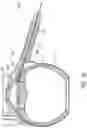 Fig. 14 - Ab externo intraocular shunt placement